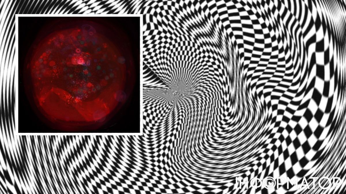 Фосфены выглядят как калейдоскопические и световые пятна разной формы и интенсивности. Фосфены выглядят как калейдоскопические и световые пятна разной формы и интенсивности.