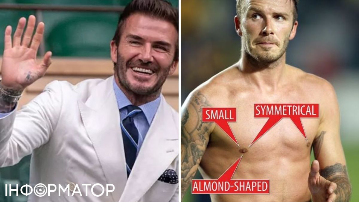 Це добре видно на фото, де він залишає поле після перемоги над командою "Лос-Анджелес Ґелаксі" на стадіоні "Home Depot Center" у Карсоні, Лос-Анджелес, у вересні 2009 року. Девіду тоді - 48 років. Це добре видно на фото, де він залишає поле після перемоги над командою "Лос-Анджелес Ґелаксі" на стадіоні "Home Depot Center" у Карсоні, Лос-Анджелес, у вересні 2009 року. Девіду тоді - 48 років.