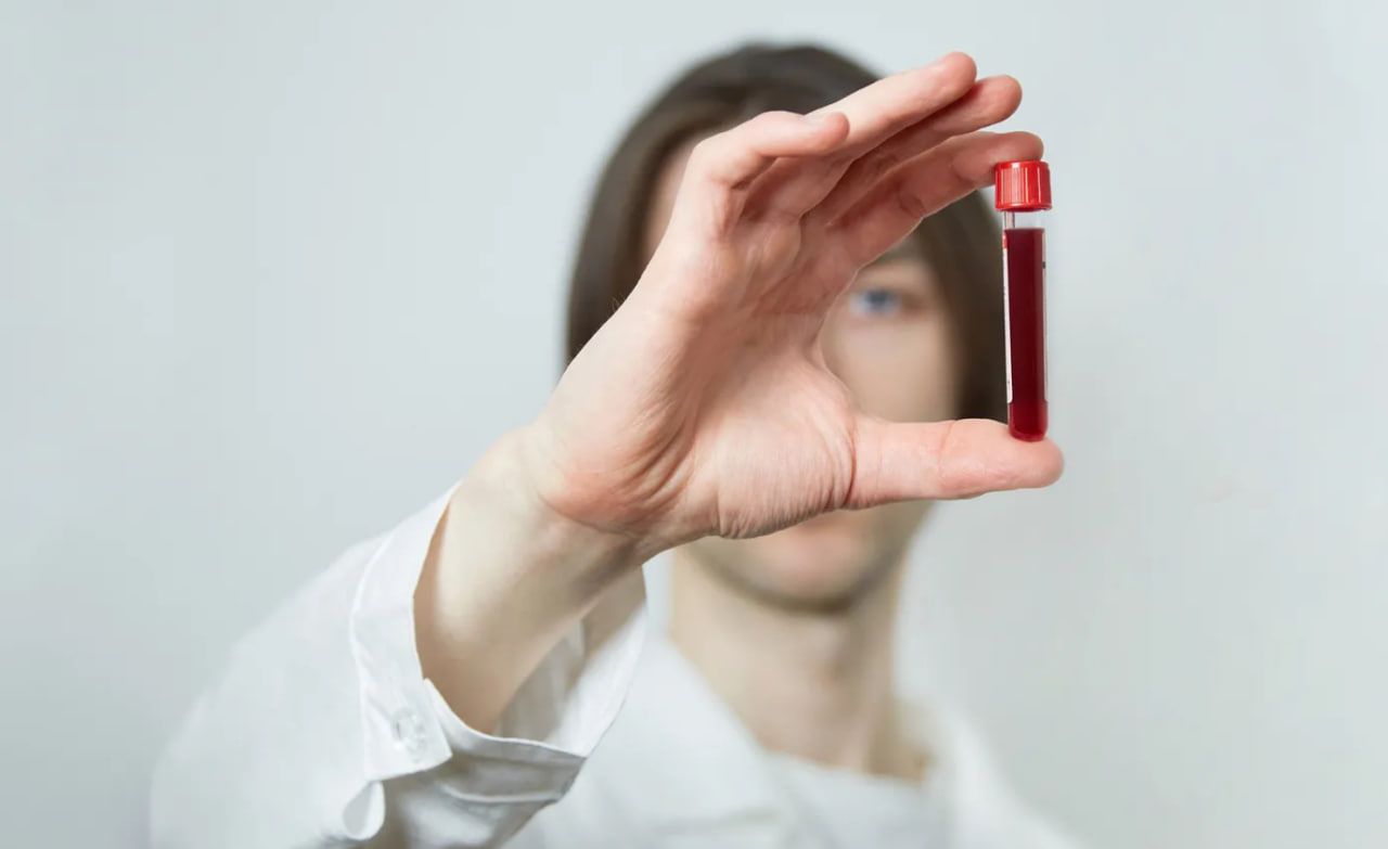 Чтобы сделать необходимые анализы, нужно иметь электронное направление. Чтобы сделать необходимые анализы, нужно иметь электронное направление.