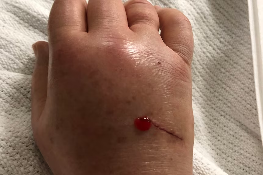 Это было так, как будто кто-то проткнул руку ножом Это было так, как будто кто-то проткнул руку ножом