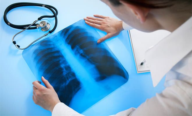 24 марта 1882 года немецкий микробиолог Генрих Кох выявил туберкулезную палочку