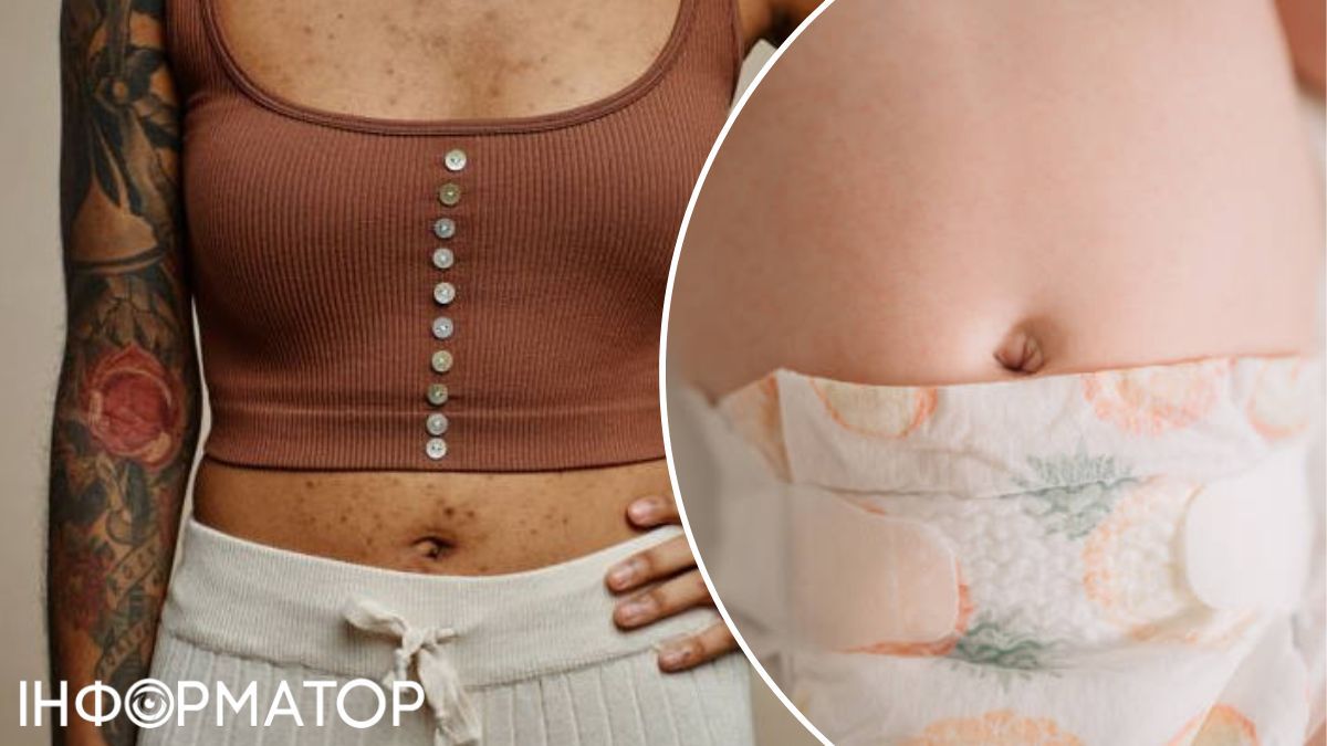 Пупок с нами – с самого рождения! Пупок с нами – с самого рождения!