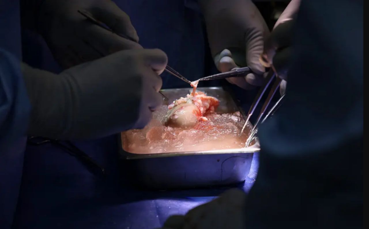 Для сумісності довелося зменшити свинячі гени та додати людські.