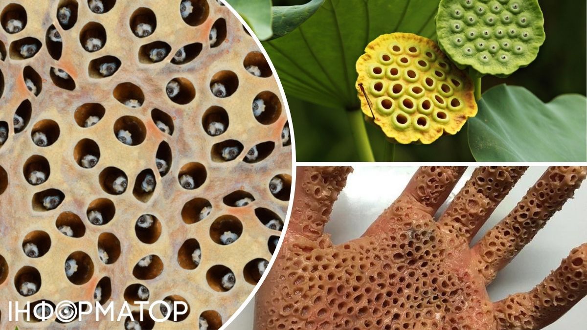 Такі зображення асоціюються з паразитами (як от червами тощо), гниттям плоті чи інфекційними ураженнями шкіри. Такі зображення асоціюються з паразитами (як от червами тощо), гниттям плоті чи інфекційними ураженнями шкіри.