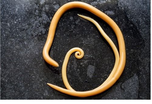 за даними дослідження 2014 року, від цього захворювання помирає 60 000 осіб на рік за даними дослідження 2014 року, від цього захворювання помирає 60 000 осіб на рік