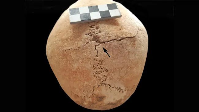 Череп, витягнутий із Сорити де лос Канес з проникаючим колотим пораненням Череп, витягнутий із Сорити де лос Канес з проникаючим колотим пораненням