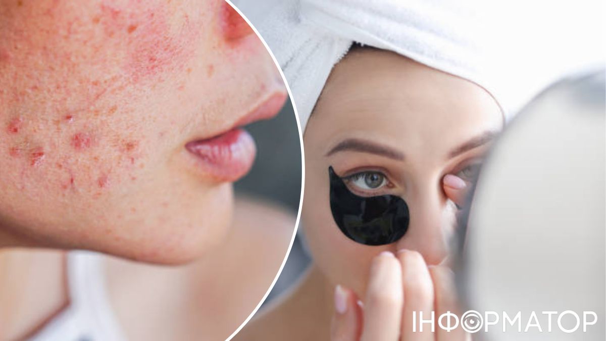 Чим би не були ваші проблеми - самостійним проявом чи симптомом небезпечної хвороби - завжди краще пересвідчитись в спеціаліста та почати лікування вчасно. Чим би не були ваші проблеми - самостійним проявом чи симптомом небезпечної хвороби - завжди краще пересвідчитись в спеціаліста та почати лікування вчасно.