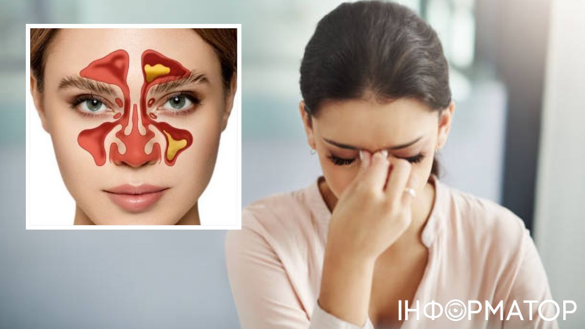 Это говорит о том, что лечение может быть эффективным только на ранних стадиях простуды. капли в нос 1