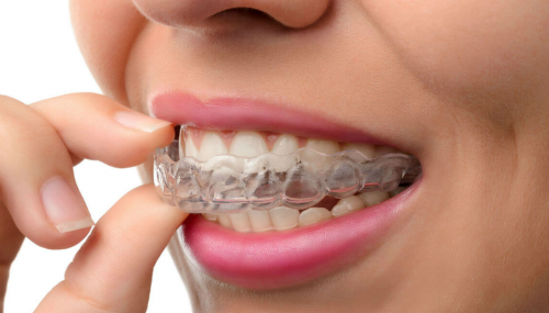 Замовити накладки на верхню щелепу можна в мероежы, коштуэ така капа в середньому від сотні гривень. Замовити накладки на верхню щелепу можна в мероежы, коштуэ така капа в середньому від сотні гривень.