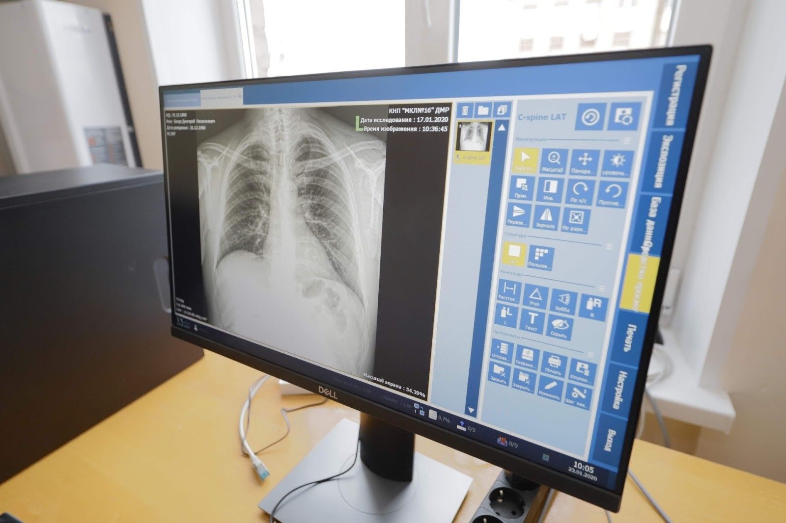 Как изменились больницы Днепра за время каденции горсовета и Бориса Филатова 5