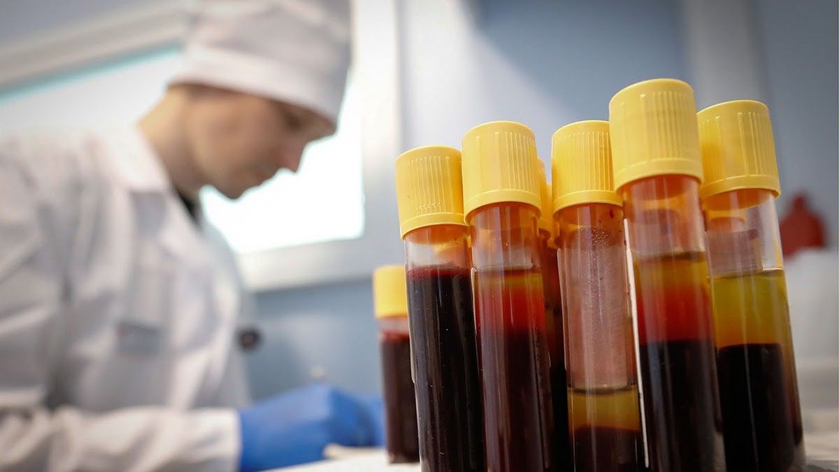 Теперь не только ВИЧ: нардепы от Киева хотят изменить наказание за умышленное заражение инфекцией