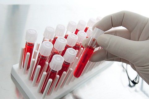Вас обвинили в алкогольном опьянении. Что делать? 3