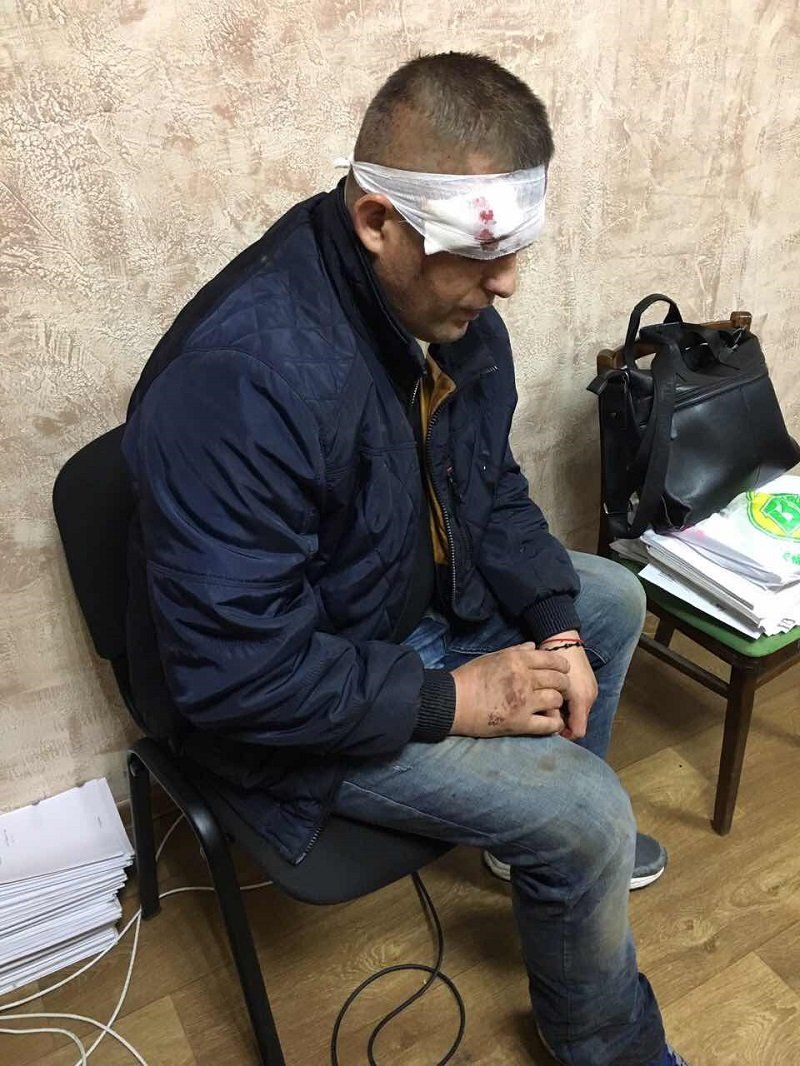 Стрельба с участием побратимов Яроша: подробности расследования 1