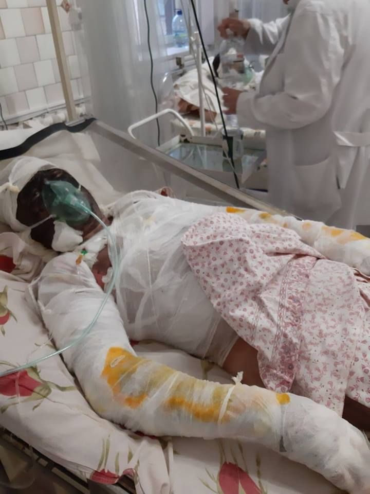 Максим Деревецкий - чудом выживший после взрыва на шахте ДТЭКа