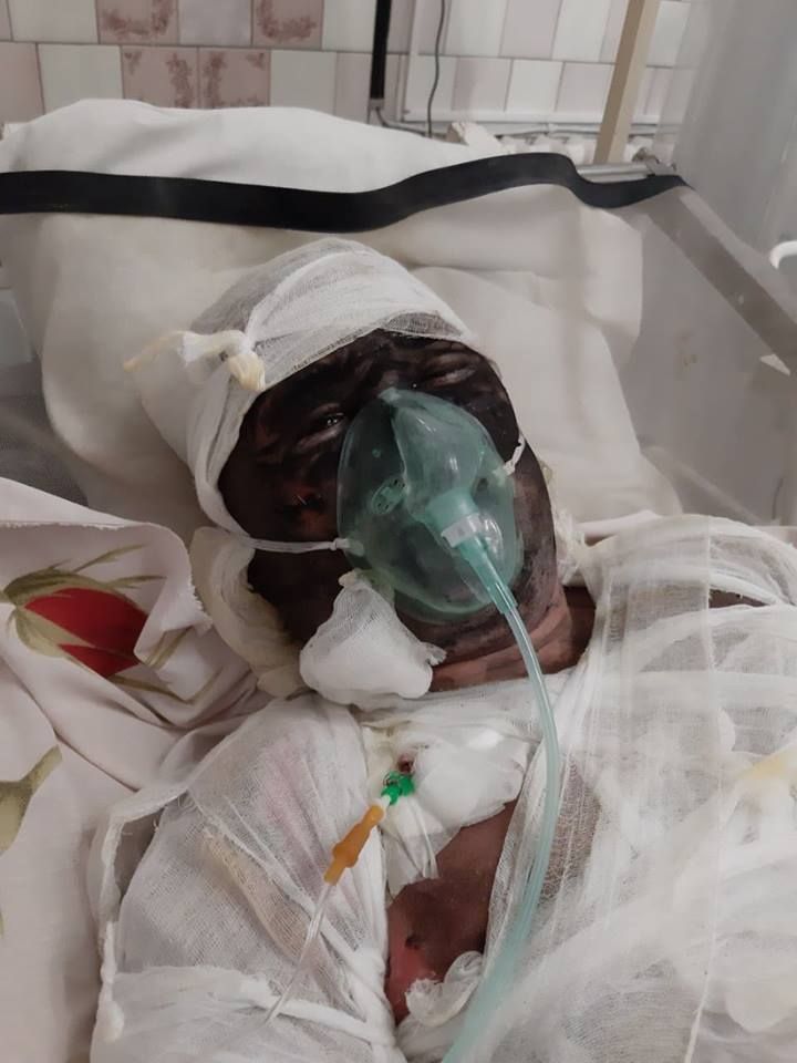 Максиму еще предстоят несколько операций