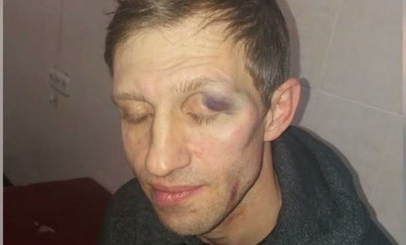 Последствия избиения