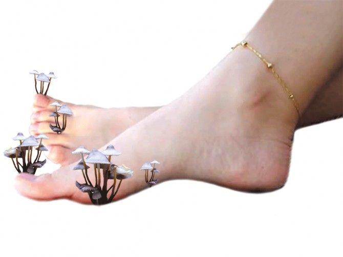 В Днепре врач рассказал, как не заболеть меланомой, грибковыми заболеваниями и безопасно ли купаться в реке 3