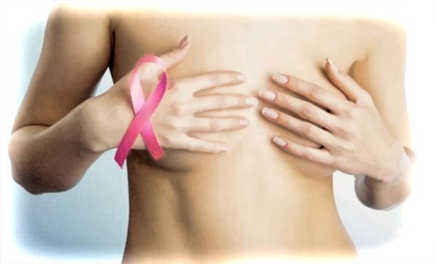 В Днепре врач рассказала, когда чаще заболевают раком молочной железы и как уберечься 4
