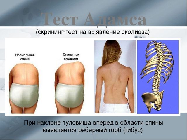 В Днепре врач ортопед-травматолог рассказал, когда надо лечить плоскостопие у детей 3