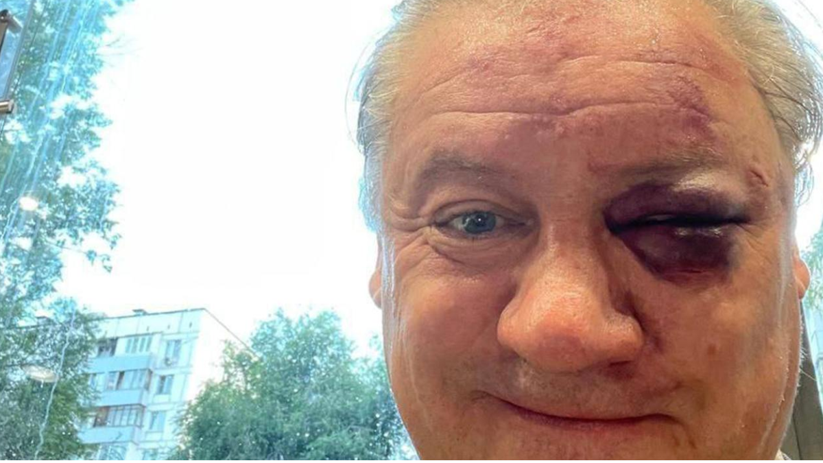 Канчельскис, эксзвезда Шахтера, Динамо и Манчестер Юнайтед получил в глаза в Москве 1