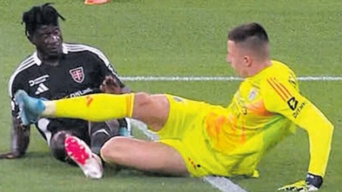 Гравець збірної України отримав жорстку травму 1