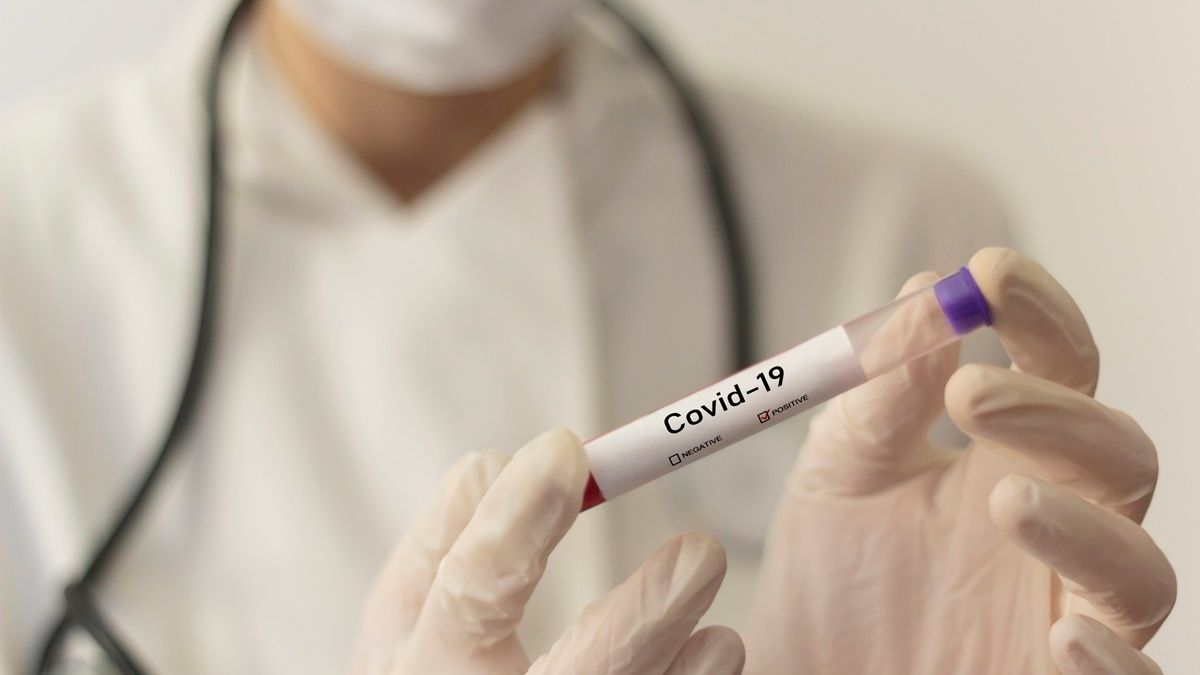 В Украине за сутки 7 915 новых случаев COVID-19