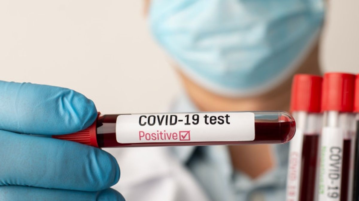В Україні за добу понад 8 тисяч нових випадків COVID-19