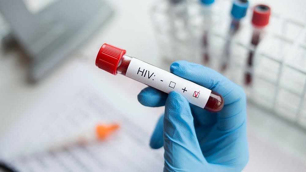 В Україні у квітні зареєстрували 1 349 нових випадків ВІЛ-інфекції