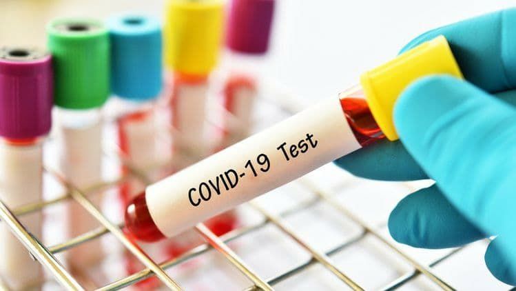 В Украине за сутки 937 новых случаев COVID-19
