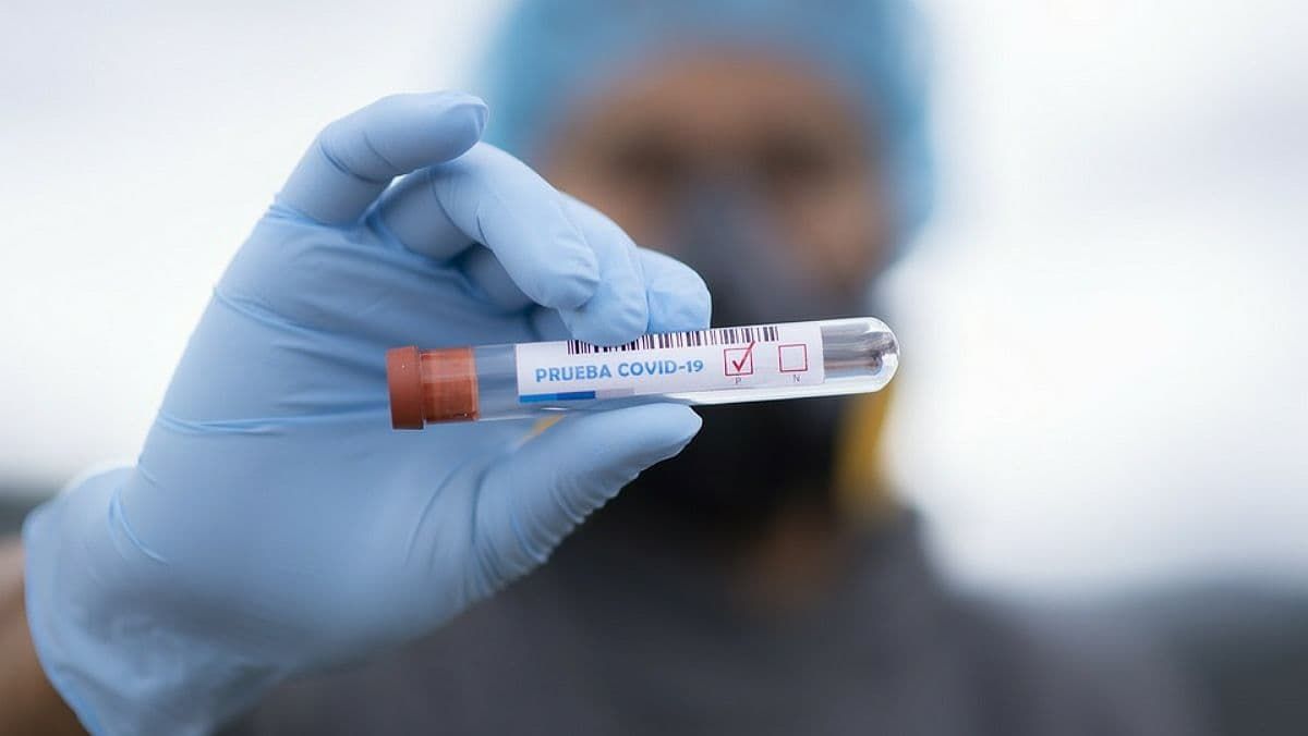 В Украине за сутки 507 новых случаев COVID-19