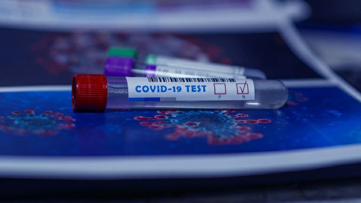 В Украине за сутки 290 новых случаев COVID-19