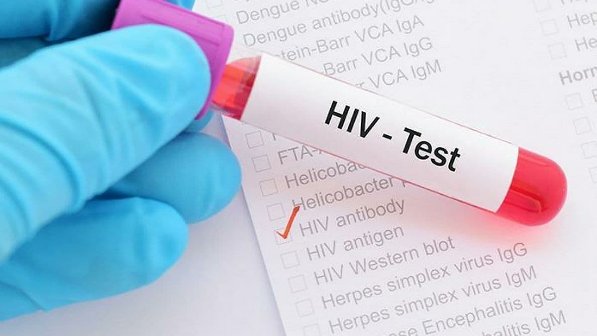 В Украине в июне зарегистрировали 1 328 новых случаев ВИЧ-инфекции