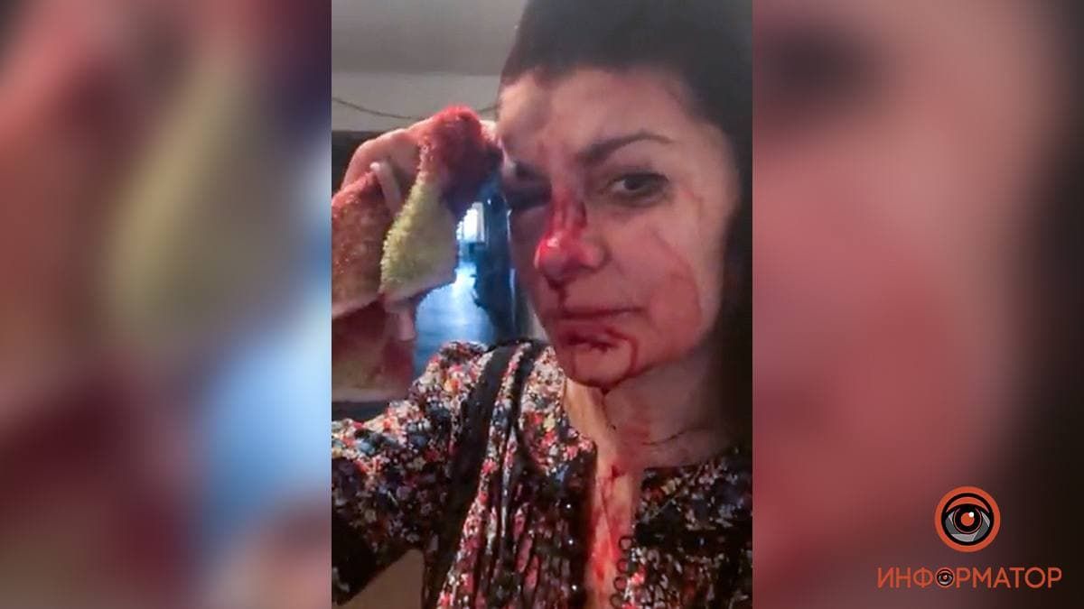 В Днепре задержали мужчин, которые жестоко избили активистку