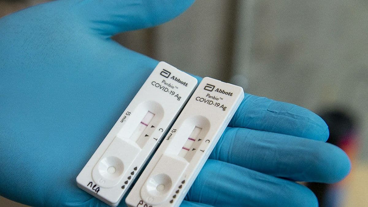 В Україні за добу 3 615 нових випадків COVID-19