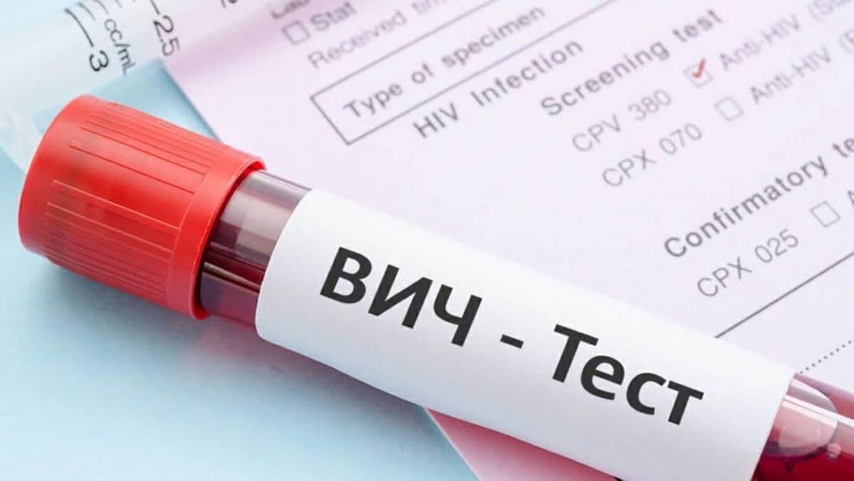 В Украине в августе зарегистрировали 1 244 новых случая ВИЧ-инфекции