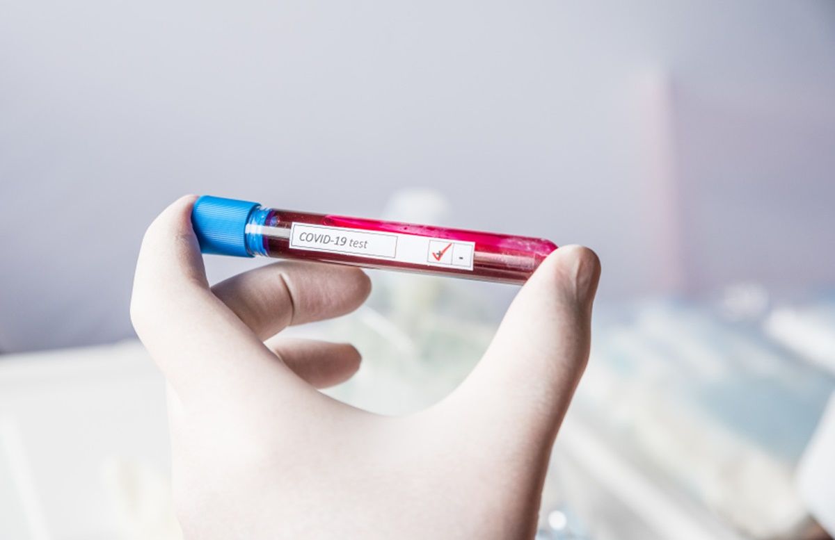 В Україні за добу 6 624 нових випадки коронавірусу