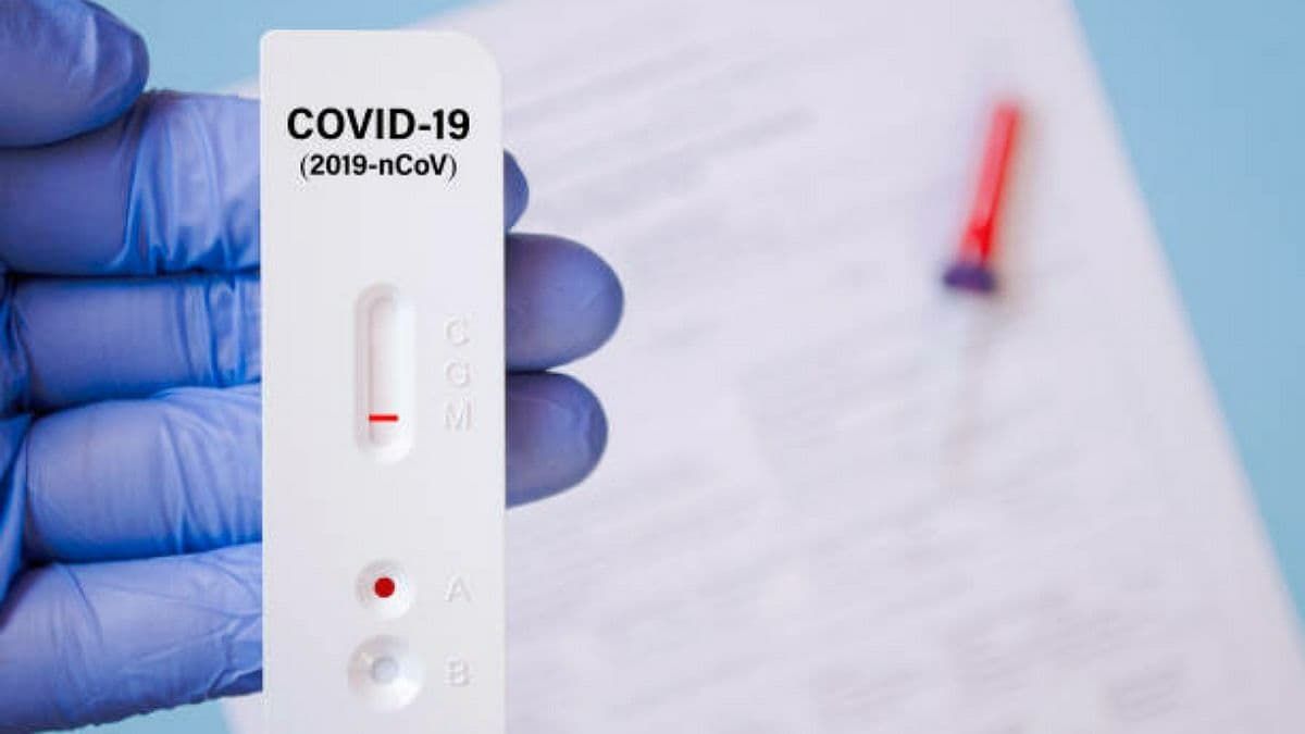 В Украине за сутки 6 363 новых случая COVID-19