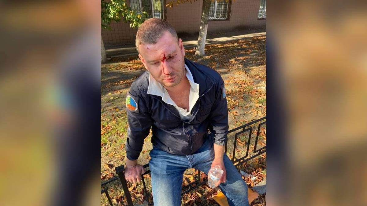 В Киеве приставят охрану к парковщикам города после того, как одного из них жестоко избили