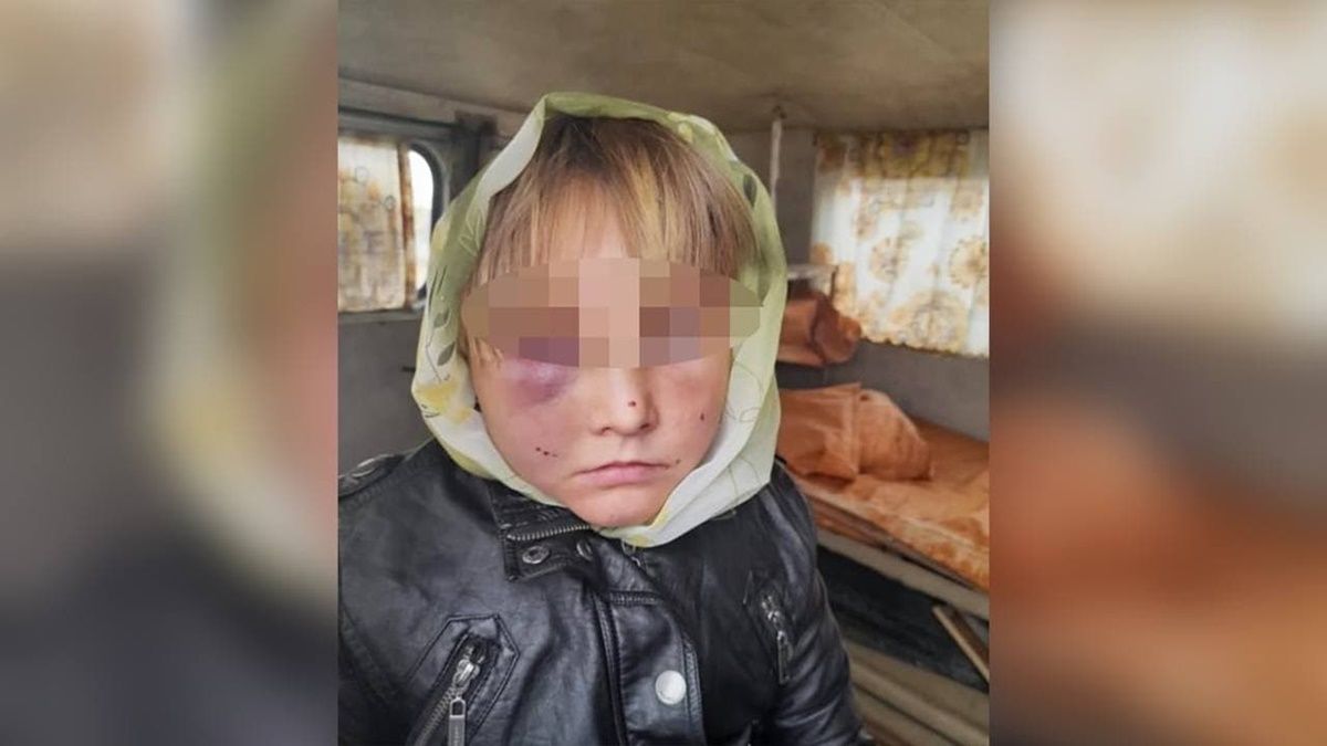 Под Житомиром мужчина жестоко избил свою жену. Пока она была в больнице, он набросился на её 8-летнюю дочь