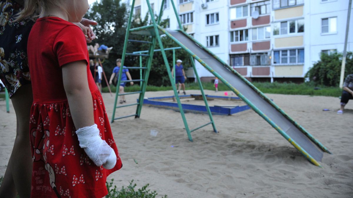 В Одессе 5-летней девочке оторвало фалангу пальца на детской площадке