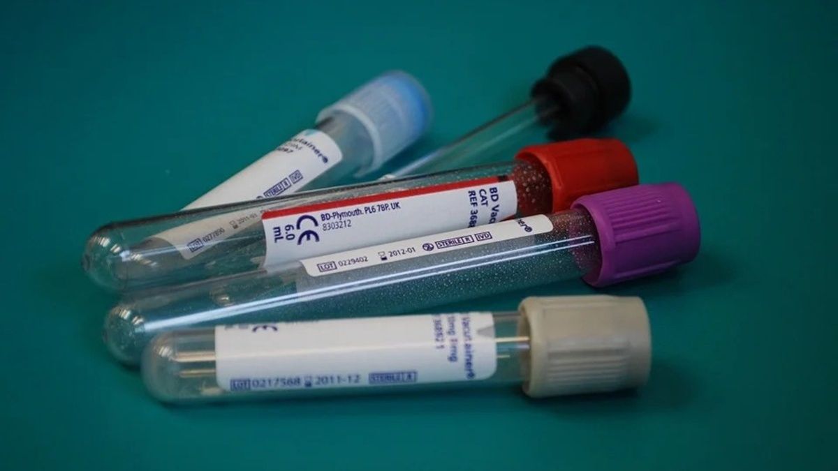В Україні за добу 7 283 нових випадків коронавірусу