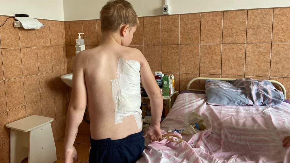 У Львові медики врятували 11-річного хлопчика з Харкова, який потрапив під касетний обстріл