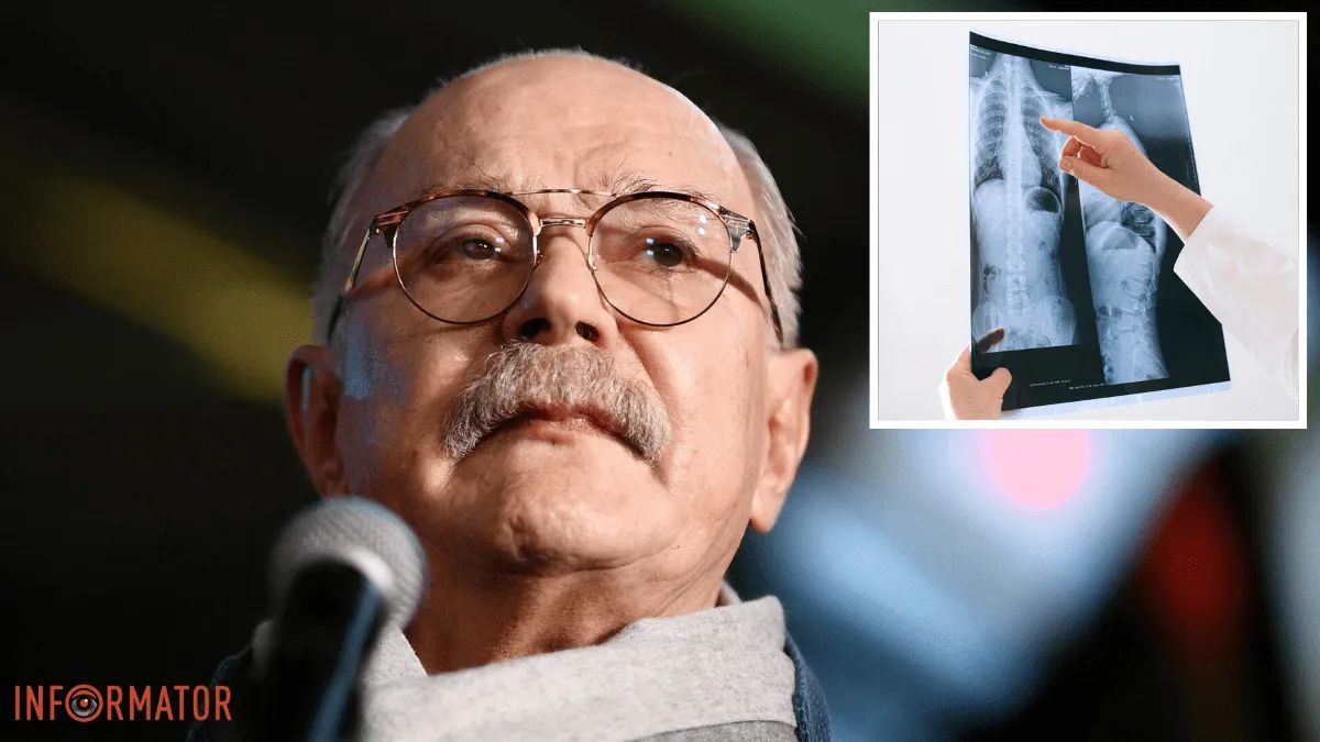 Стан Микити Михалкова покращився, але про одужання говорити ще зарано