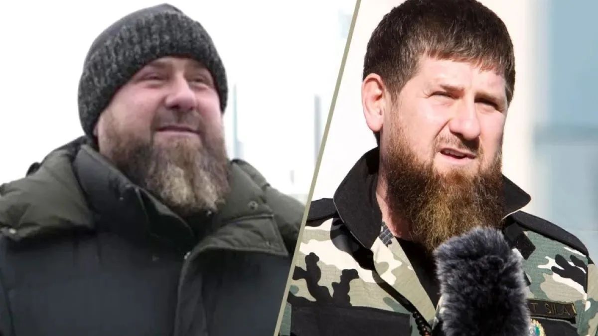 Запухлому Кадирову привезли лікаря з Еміратів, у нього відмовляють нирки - ЗМІ