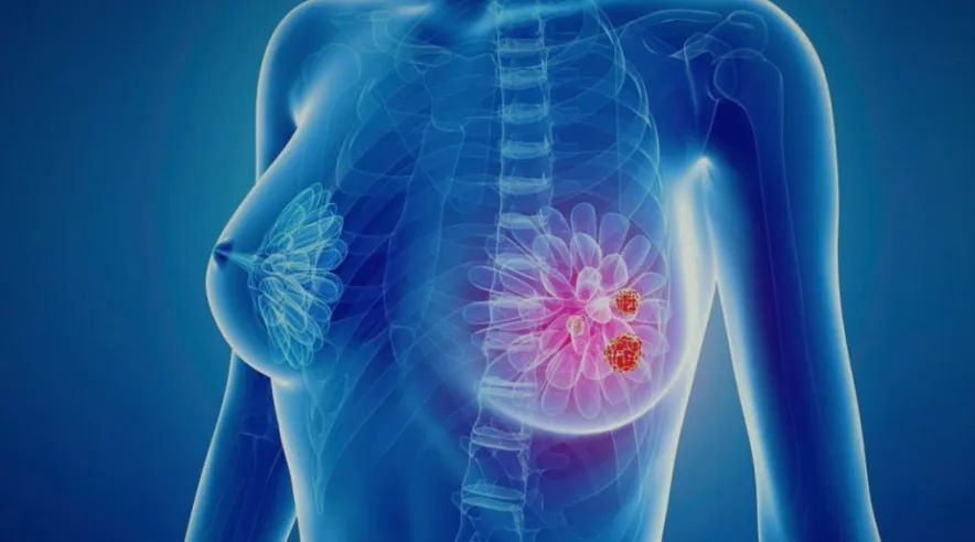 В течение октября много событий и мероприятий, связанных с раком молочной железы