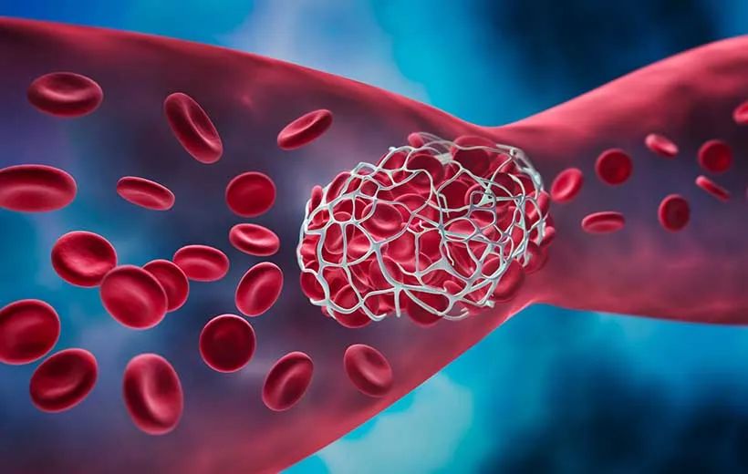 Его цель – обратить внимание на опасность тромбоза, поощрять людей посещать врачей и не заниматься самолечением