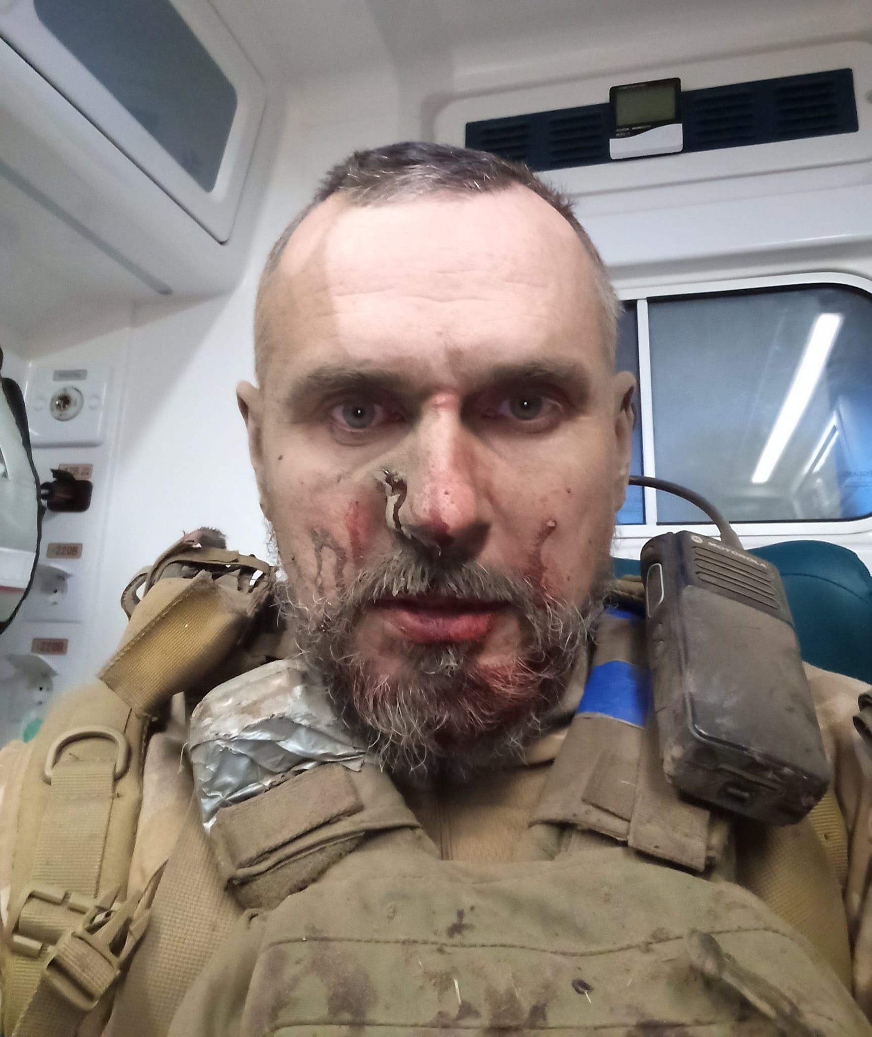 Після артобстрілу Після артобстрілу