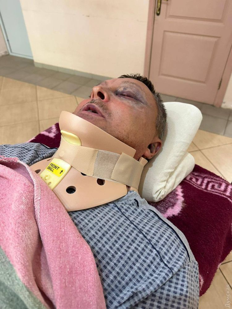В Одесской области с серьезными травмами госпитализировали военного: его избили посреди улицы - видео 2