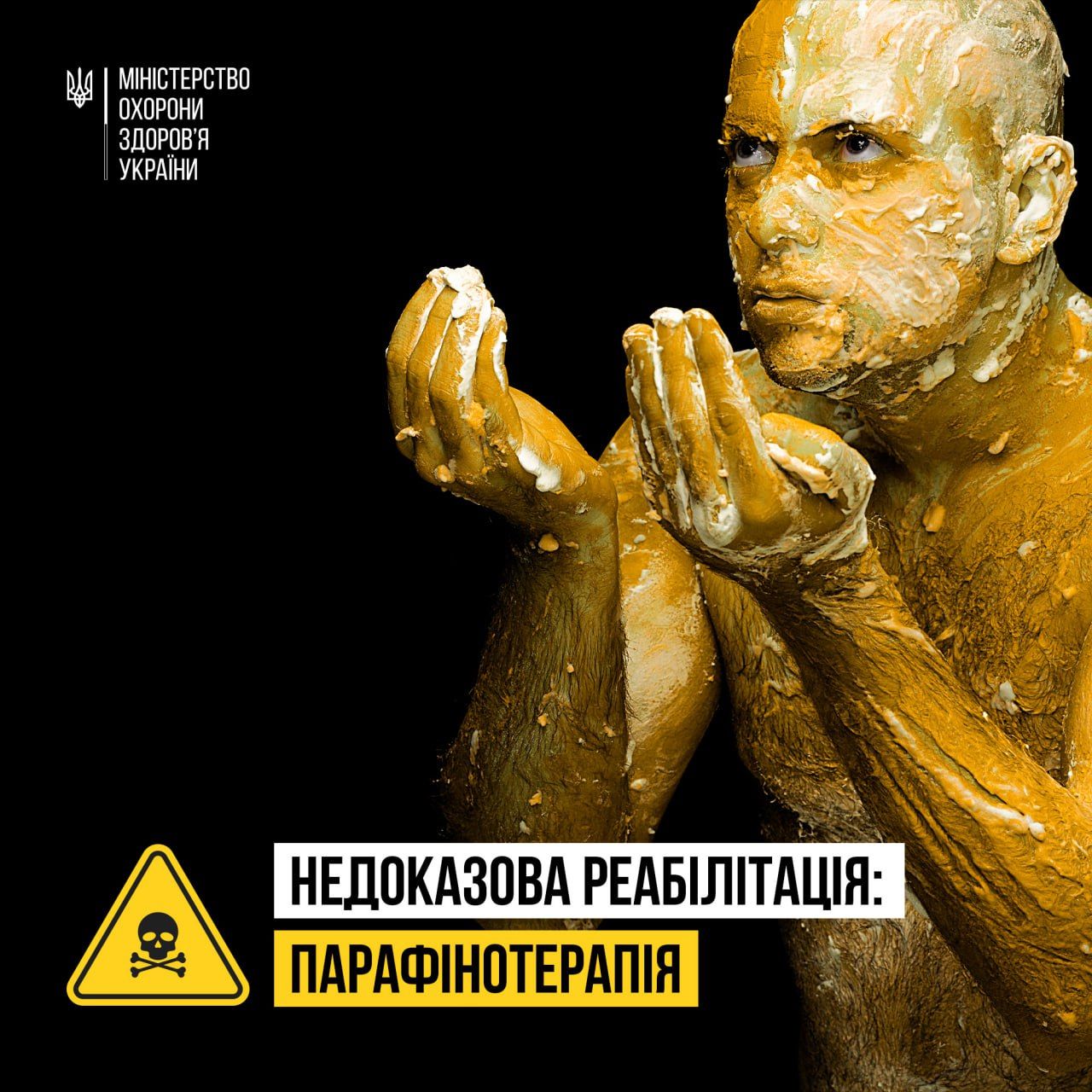 В МОЗ висловили застереження щодо ефективносіт так званої парафінотерапії.  В МОЗ висловили застереження щодо ефективносіт так званої парафінотерапії.