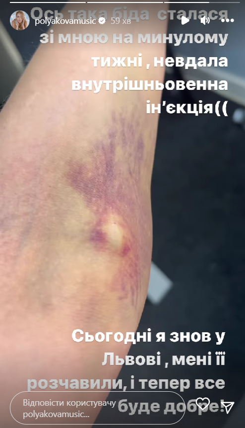 Минулого місяця Оля Полякова серйозно захворіла Минулого місяця Оля Полякова серйозно захворіла